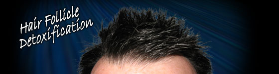 Hair Follicle Detoxification